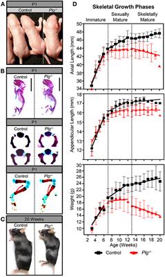 The Deleterious Effects of Impaired Fibrinolysis on Skeletal Development Are Dependent on Fibrin(ogen), but Independent of Interlukin-6